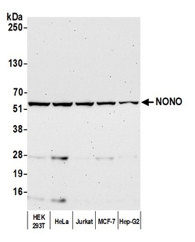 Rabbit NONO Antibody