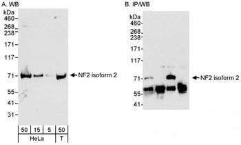 Rabbit NF2 Antibody
