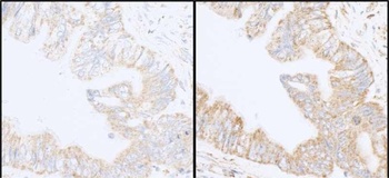 Rabbit INPPL1/SHIP2 Antibody
