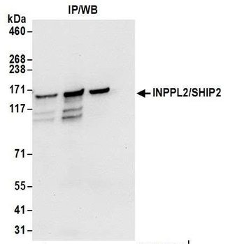 Rabbit INPPL1/SHIP2 Antibody