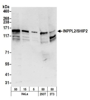 Rabbit INPPL1/SHIP2 Antibody