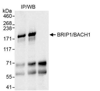 Rabbit BRIP1/BACH1 Antibody