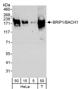 Rabbit BRIP1/BACH1 Antibody