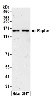 Rabbit Raptor Antibody