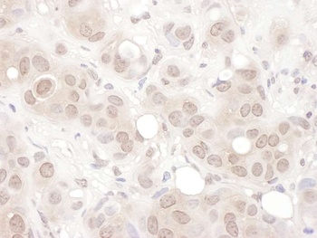 Rabbit REST Antibody