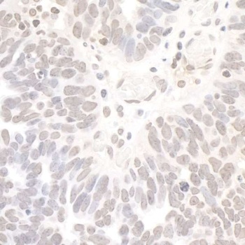 Rabbit REST Antibody