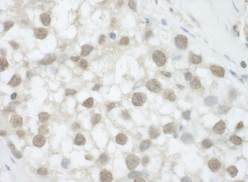 Rabbit DHX36 Antibody