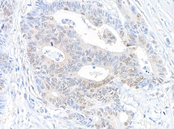 Rabbit RanBP1 Antibody