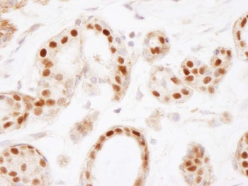 Rabbit Estrogen Receptor Alpha Antibody