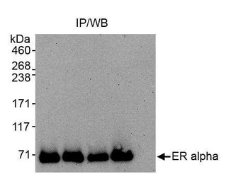 Rabbit Estrogen Receptor Alpha Antibody