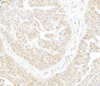 Rabbit Lasu1/Ureb1 Antibody