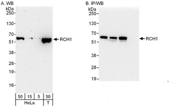 Rabbit RCH1/KPNA2 Antibody