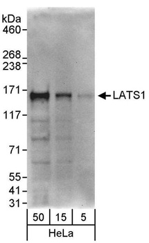 Rabbit LATS1 Antibody
