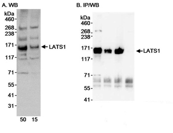 Rabbit LATS1 Antibody