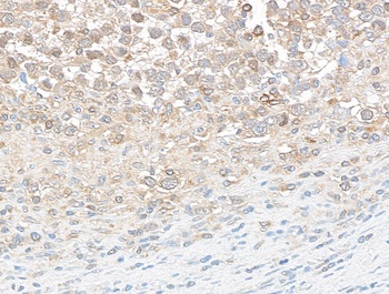 Rabbit DDX3 Antibody