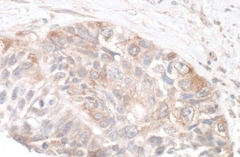 Rabbit Rictor Antibody