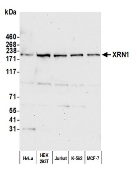 Rabbit XRN1 Antibody