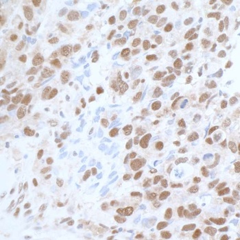 Rabbit CARM1 Antibody