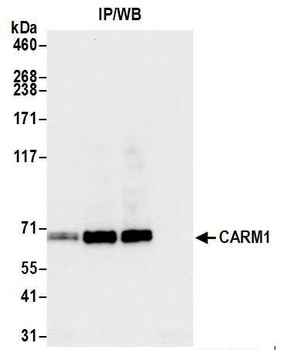 Rabbit CARM1 Antibody