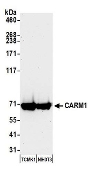 Rabbit CARM1 Antibody