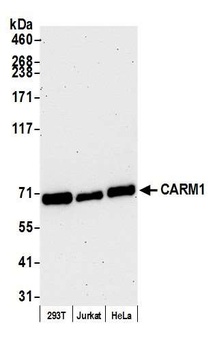 Rabbit CARM1 Antibody