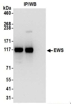 Rabbit EWS Antibody