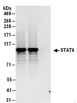 Rabbit anti-STAT6 Antibody