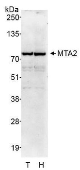 Rabbit MTA2 Antibody