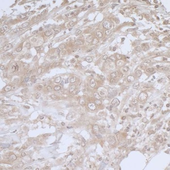 Rabbit BIRC6/Apollon Antibody