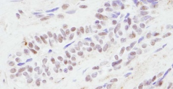 Rabbit CBP Antibody