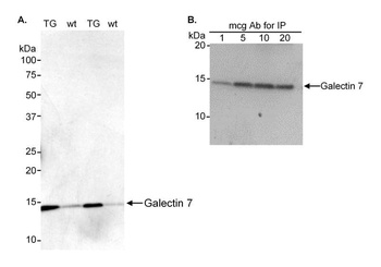 Rabbit Galectin-7 Antibody