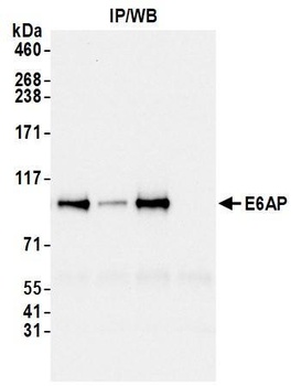 Rabbit E6AP Antibody