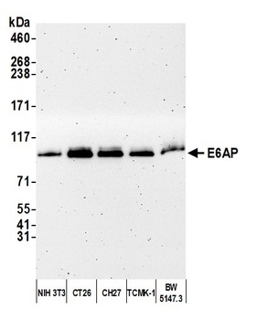 Rabbit E6AP Antibody
