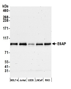 Rabbit E6AP Antibody