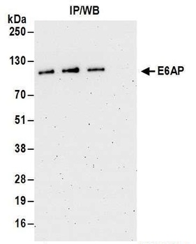 Rabbit E6AP Antibody