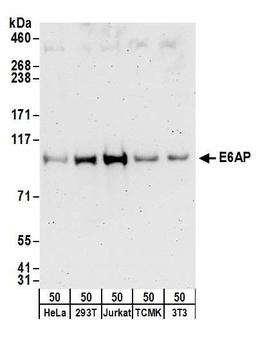 Rabbit E6AP Antibody
