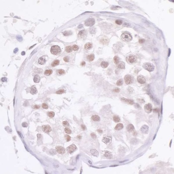 Rabbit NCOA2/SRC2 Antibody