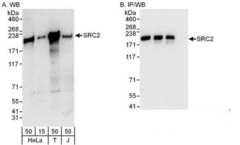 Rabbit NCOA2/SRC2 Antibody