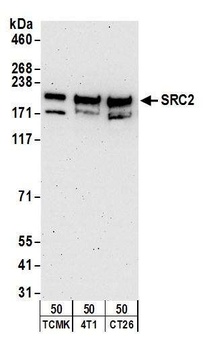 Rabbit NCOA2/SRC2 Antibody