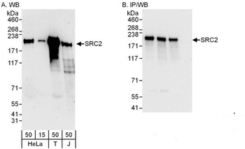 Rabbit NCOA2/SRC2 Antibody