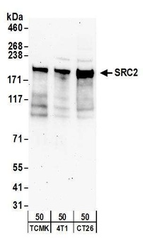 Rabbit NCOA2/SRC2 Antibody