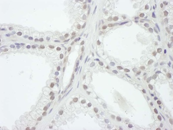 Rabbit SRC1 Antibody