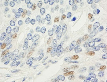 Rabbit MAD1 Antibody
