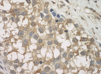 Rabbit JLP Antibody