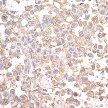 Rabbit JLP Antibody