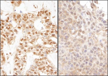 Rabbit Ubiquitin Antibody