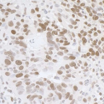 Rabbit anti-FUS Antibody