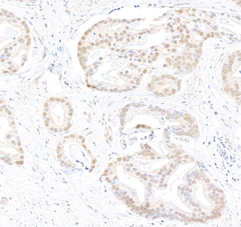 Rabbit Caper Antibody
