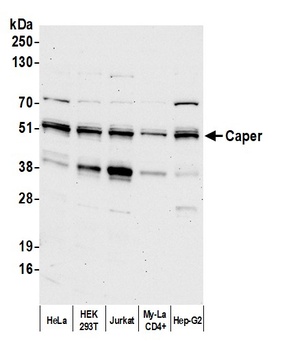 Rabbit Caper Antibody