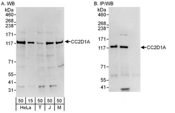 Rabbit CC2D1A Antibody